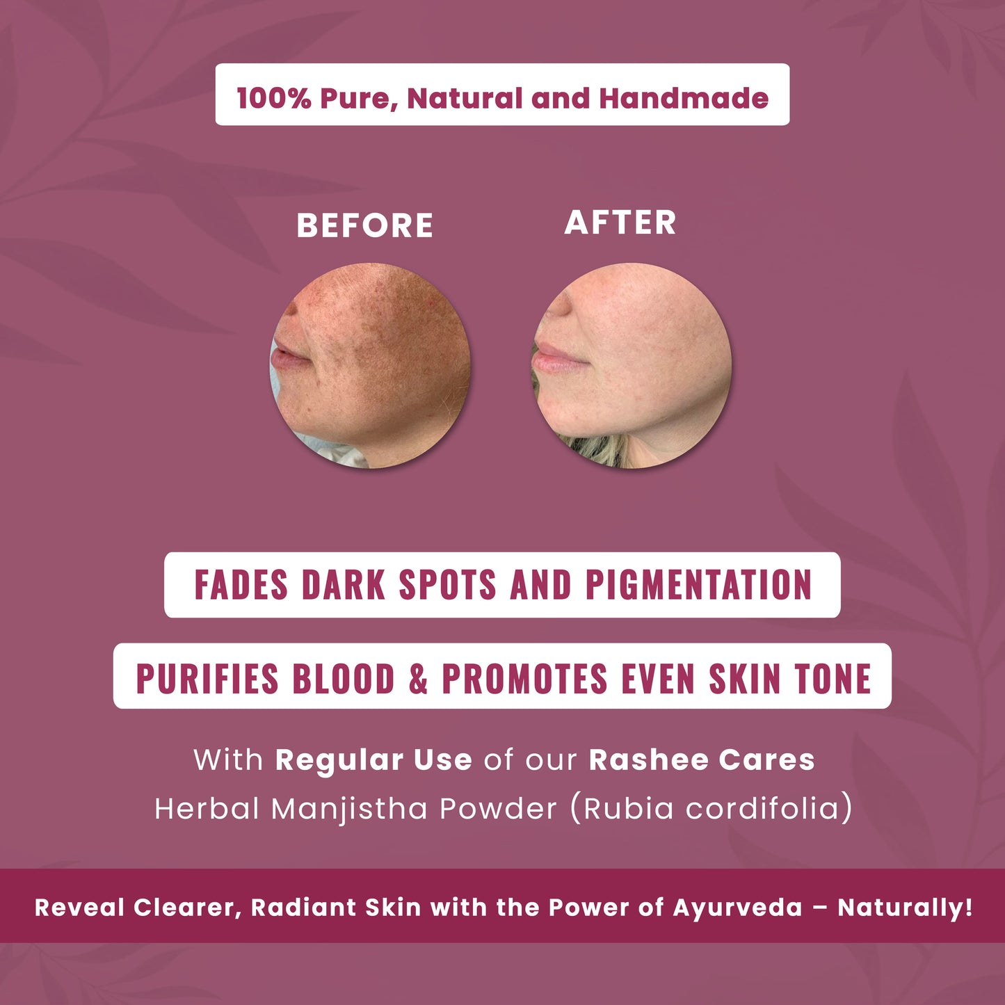 Rashee Cares Herbal Manjistha Powder