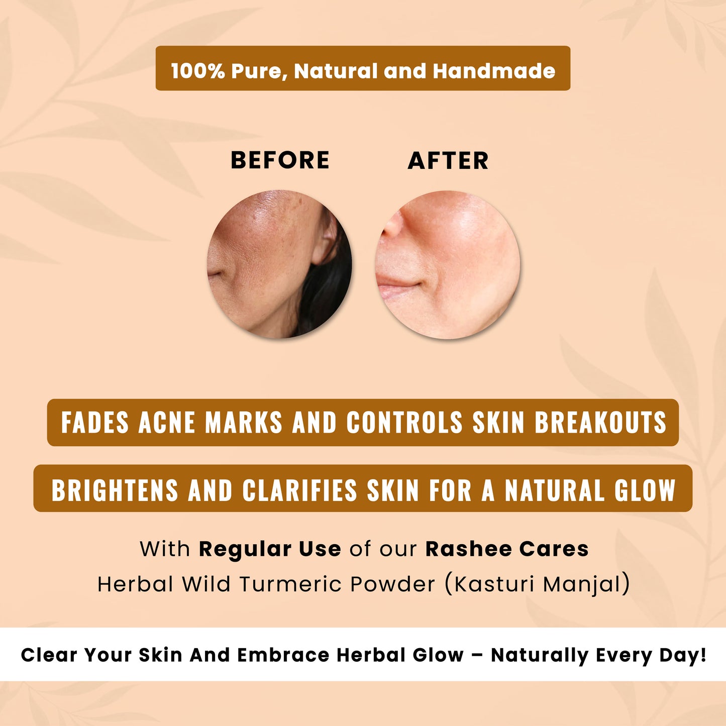Rashee Cares Herbal Wild Turmeric Powder