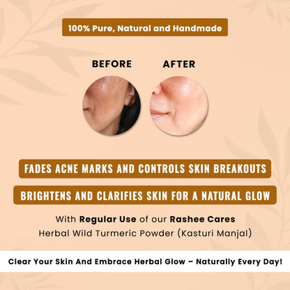 Rashee Cares Herbal Wild Turmeric Powder